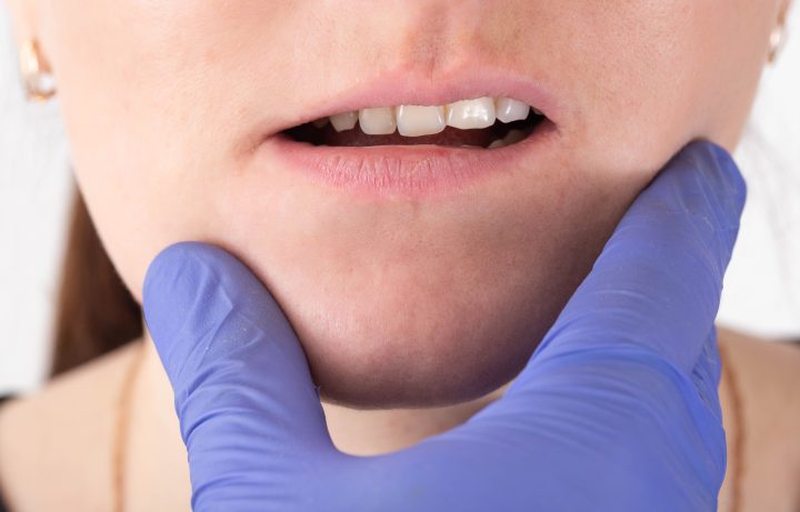 Maloclusión dental en Las Palmas