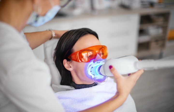 después de un blanqueamiento dental